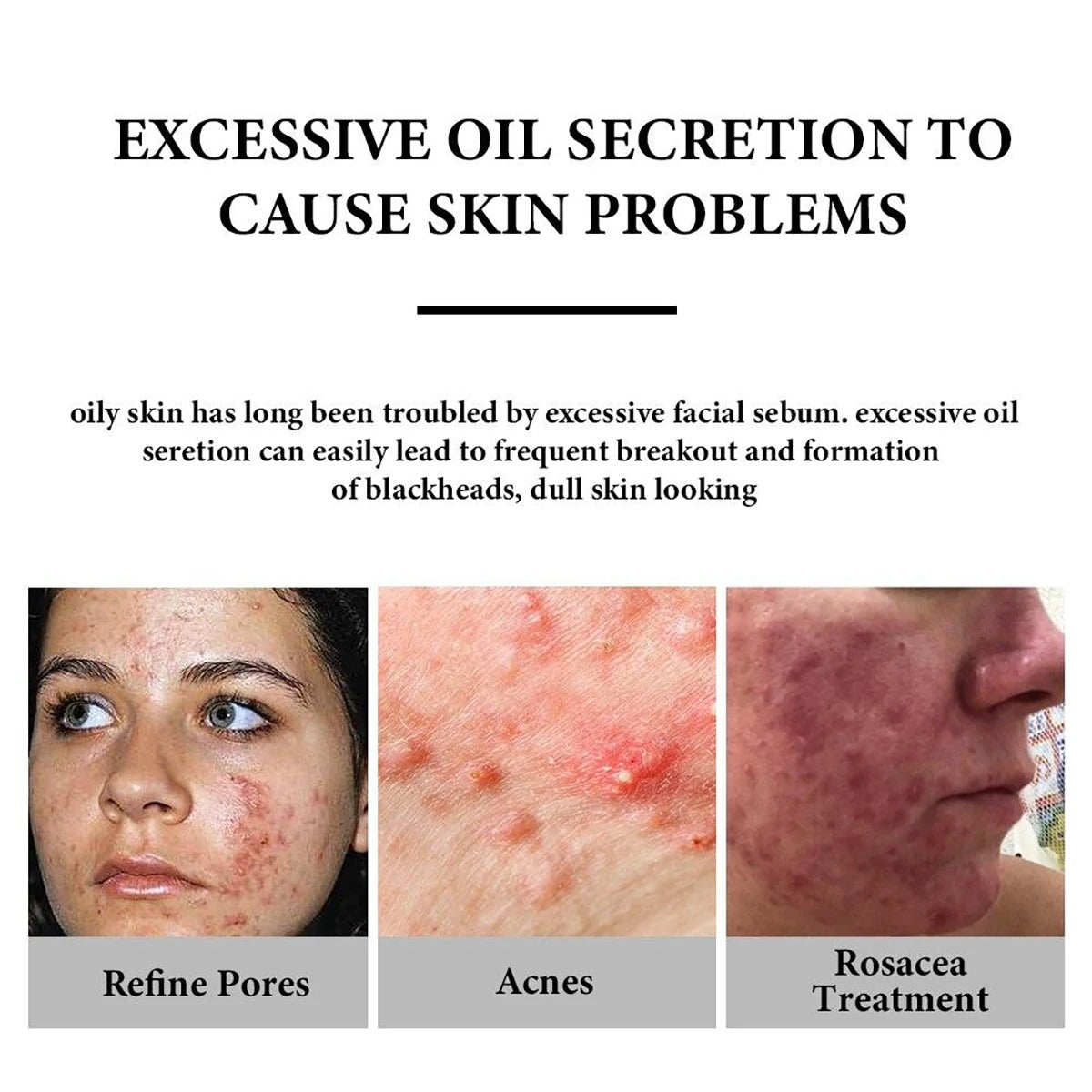 Skin Care